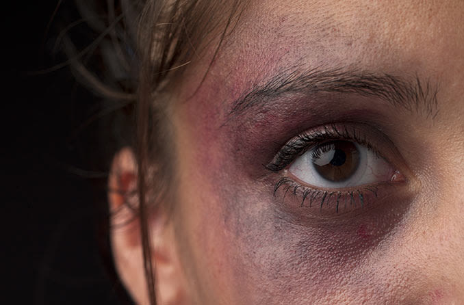  Adolescente de 14 anos teria sido agredida pelo pai no Nova Itupeva