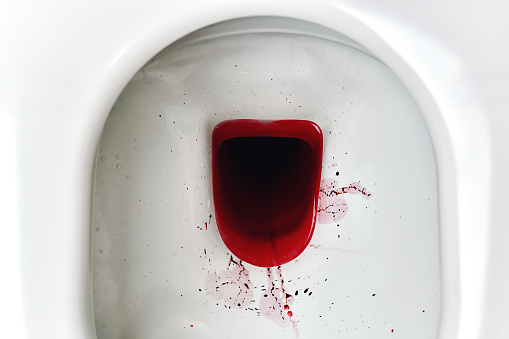 Suposto feto de aborto era apenas coágulo de menstruação